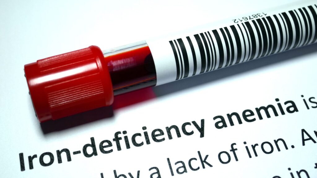 The 4 Main Causes of Iron Deficiency Anemia