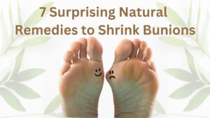 How to Shrink Bunions Naturally