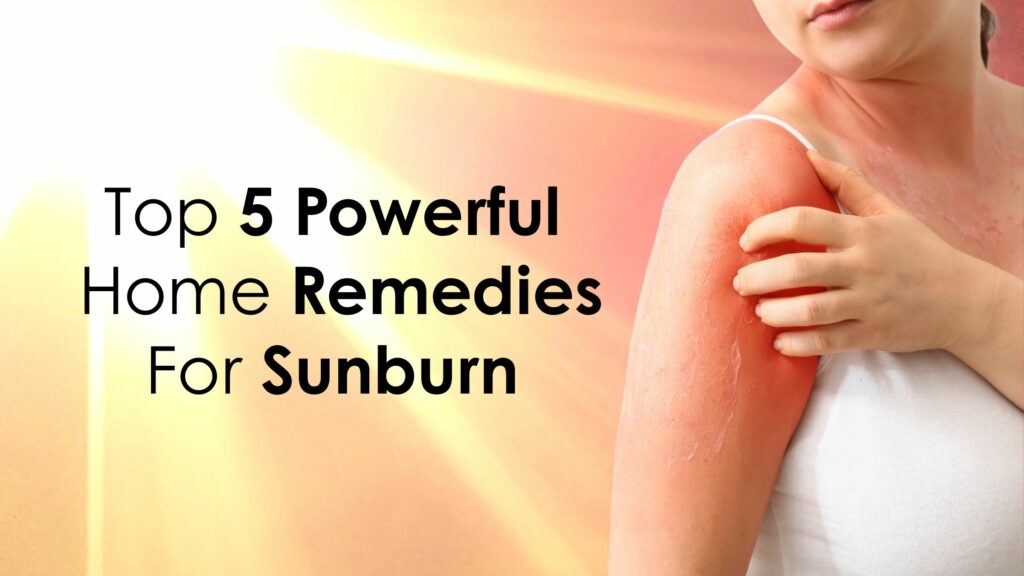 How to Get Rid of Sunburn Redness Overnight