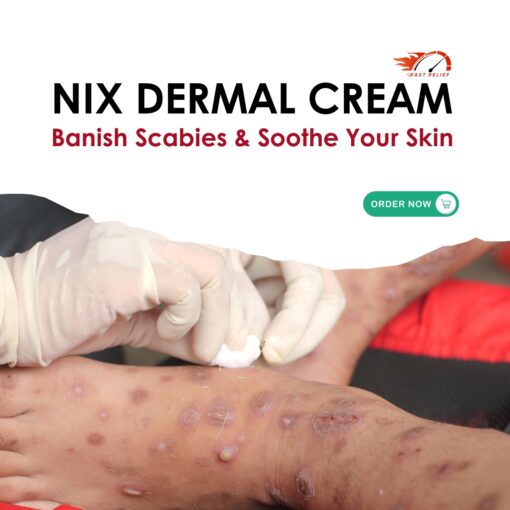 Nix Dermal Cream 30g buy online